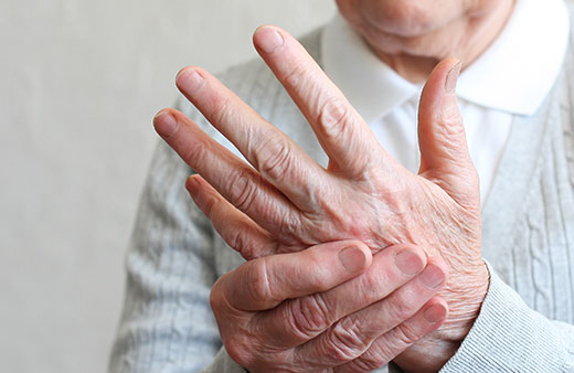 Arthritis (Rheumatoid Factor) Home Test Kit UK Arthritis (Rheumatoid Factor) Home Test Kit UK